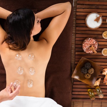 High Angle View Of A Relaxed Young Woman Receiving Cupping Treatment On Back